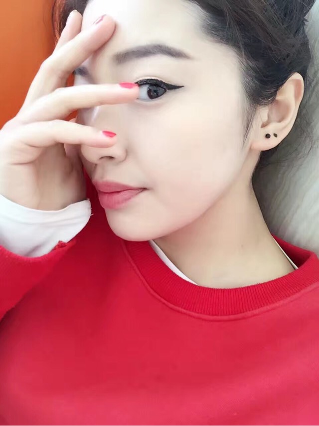 20170328174809_89987.jpg